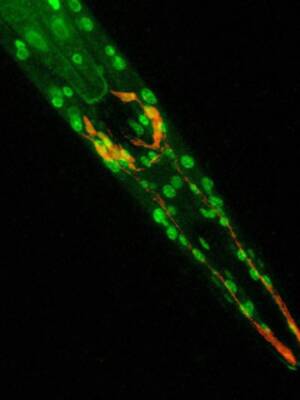 Científicos de la Universidad Pablo de Olavide hallan la cura para la diabetes del gusano C.Elegans